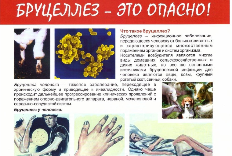 Бруцеллез. Бруцеллез.